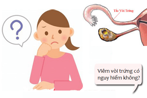 Viêm vòi trứng có nguy hiểm không?